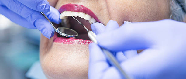 Best Emergency Tooth Extraction in Roland, OK